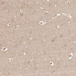 Atlas Antibodies Anti-MAPK1 Antibody