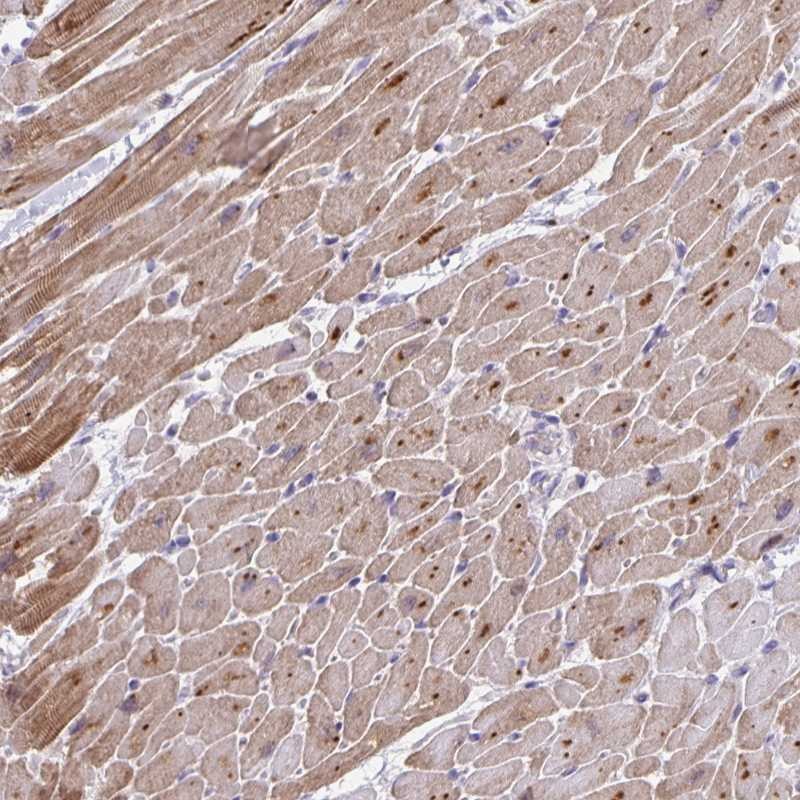 Atlas Antibodies Anti-MAPK12 Antibody