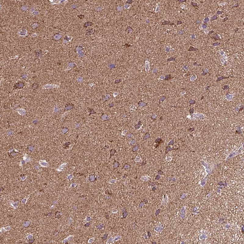Atlas Antibodies Anti-MAPK11 Antibody