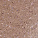 Atlas Antibodies Anti-MAPK11 Antibody