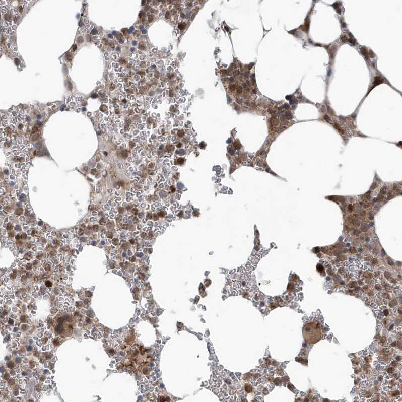Atlas Antibodies Anti-MAPK1IP1L Antibody