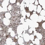 Atlas Antibodies Anti-MAPK1IP1L Antibody