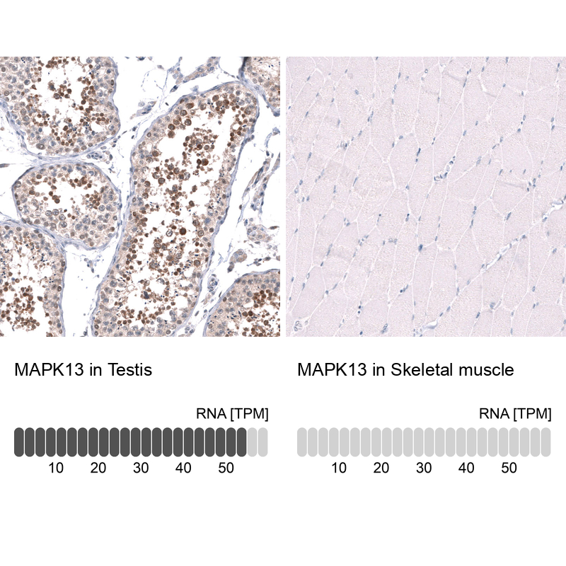 Atlas Antibodies Anti-MAPK13 Antibody