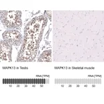 Atlas Antibodies Anti-MAPK13 Antibody