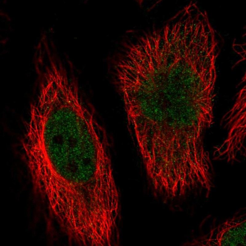 Atlas Antibodies Anti-MAPK7 Antibody