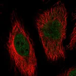 Atlas Antibodies Anti-MAPK7 Antibody