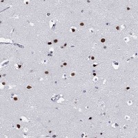Atlas Antibodies Anti-MAPK8IP1 Antibody