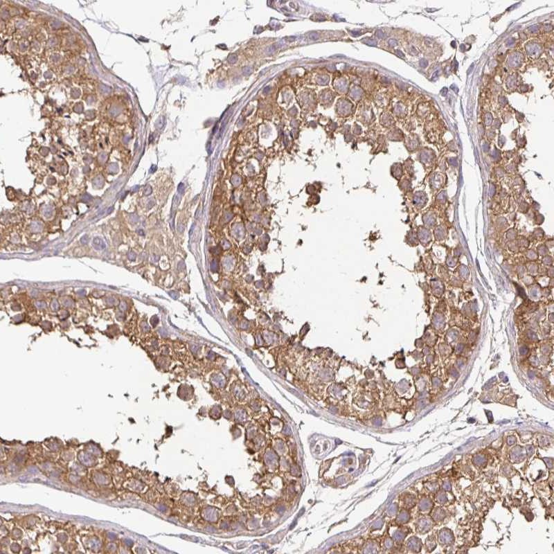 Atlas Antibodies Anti-MAPK8IP3 Antibody