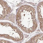 Atlas Antibodies Anti-MAPK8IP3 Antibody
