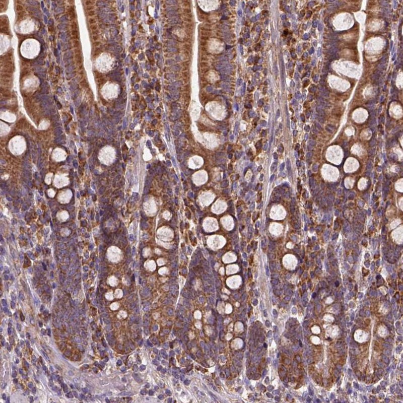 Atlas Antibodies Anti-MAPK8IP3 Antibody