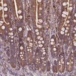 Atlas Antibodies Anti-MAPK8IP3 Antibody