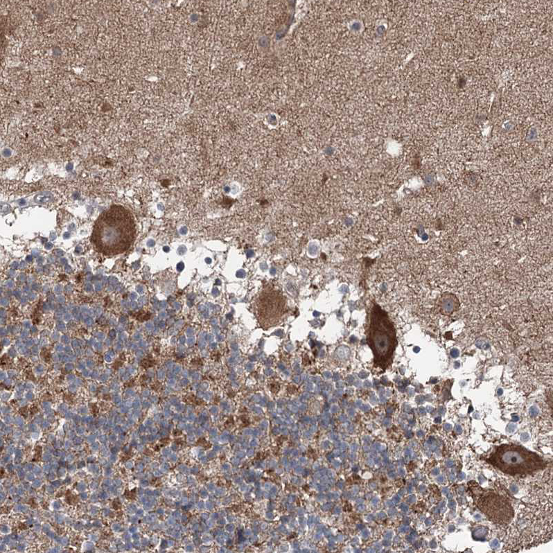 Atlas Antibodies Anti-MAPK8IP2 Antibody