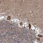 Atlas Antibodies Anti-MAPK8IP2 Antibody