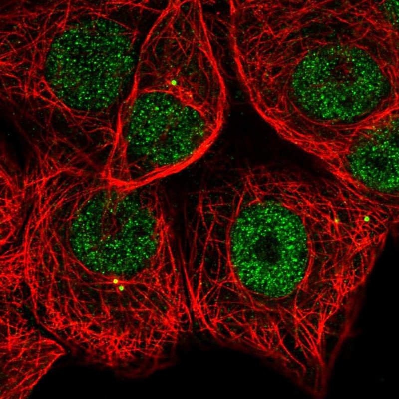 Atlas Antibodies Anti-MAPKAPK2 Antibody