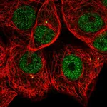 Atlas Antibodies Anti-MAPKAPK2 Antibody