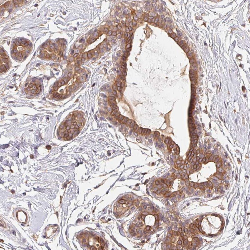 Atlas Antibodies Anti-MAPKAPK2 Antibody