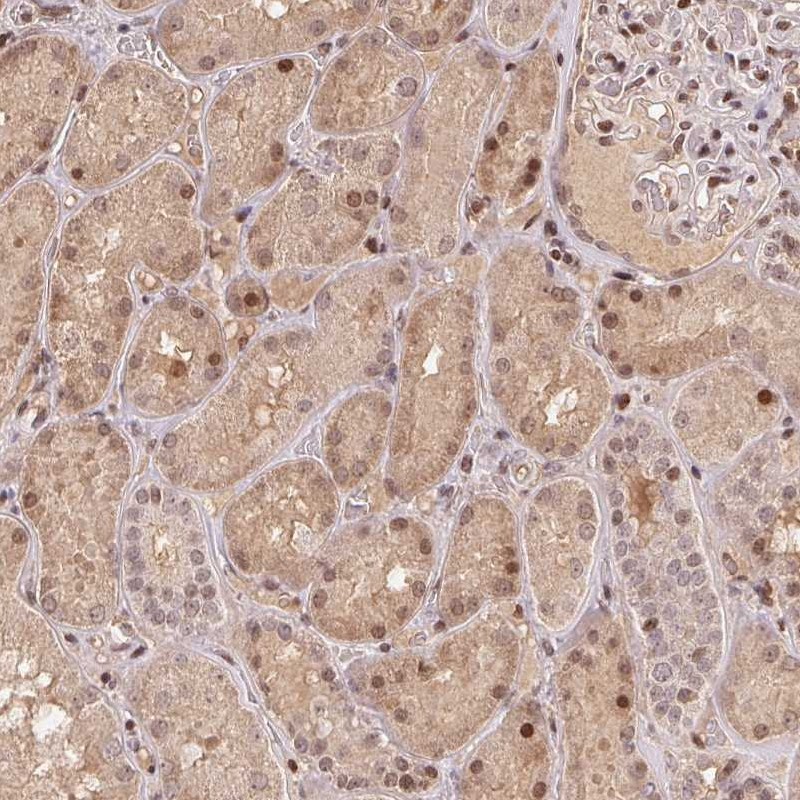 Atlas Antibodies Anti-MAPKAPK2 Antibody