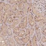 Atlas Antibodies Anti-MAPKAPK2 Antibody