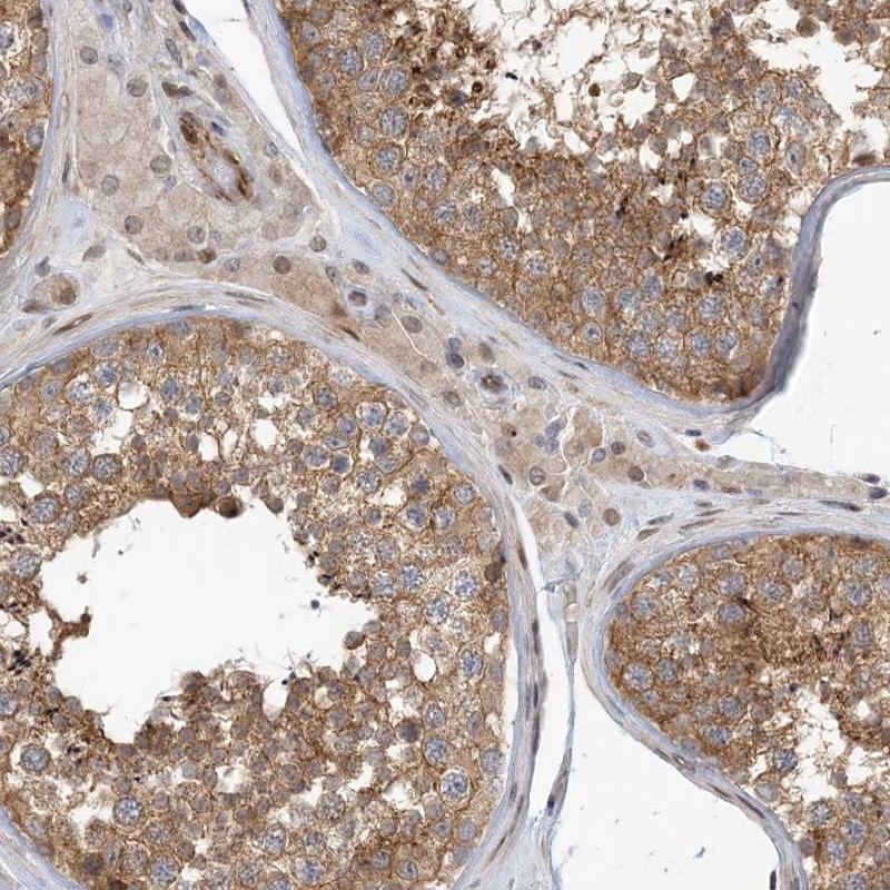 Atlas Antibodies Anti-MAPKBP1 Antibody