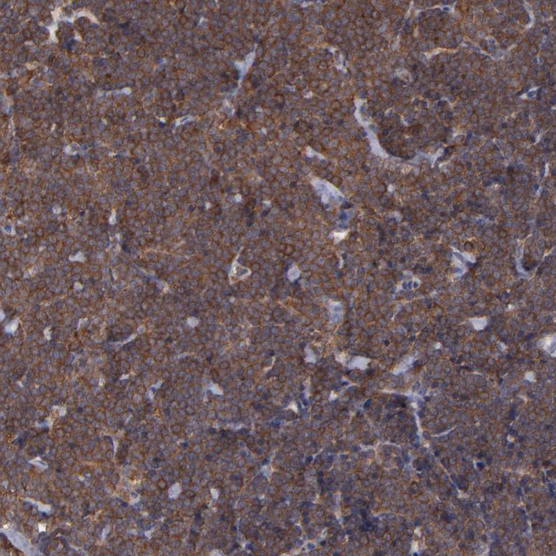 Atlas Antibodies Anti-MAPRE1 Antibody