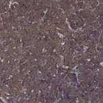 Atlas Antibodies Anti-MAPRE1 Antibody