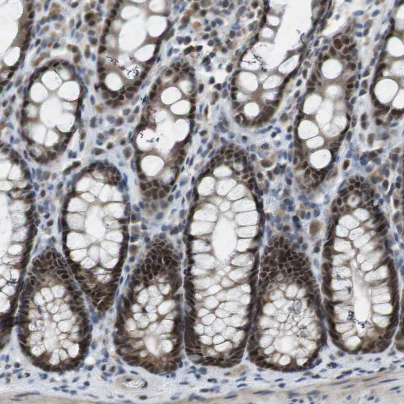 Atlas Antibodies Anti-MAPKAPK5 Antibody