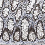 Atlas Antibodies Anti-MAPKAPK5 Antibody
