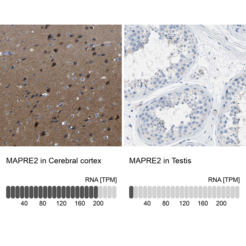 Atlas Antibodies Anti-MAPRE2 Antibody