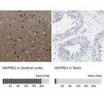 Atlas Antibodies Anti-MAPRE2 Antibody
