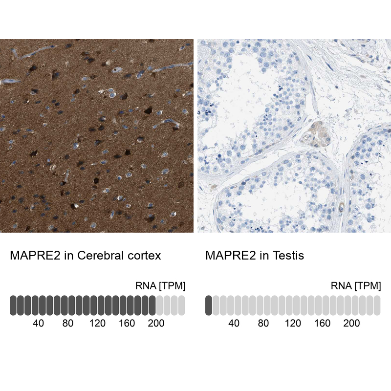 Atlas Antibodies Anti-MAPRE2 Antibody
