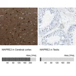 Atlas Antibodies Anti-MAPRE2 Antibody