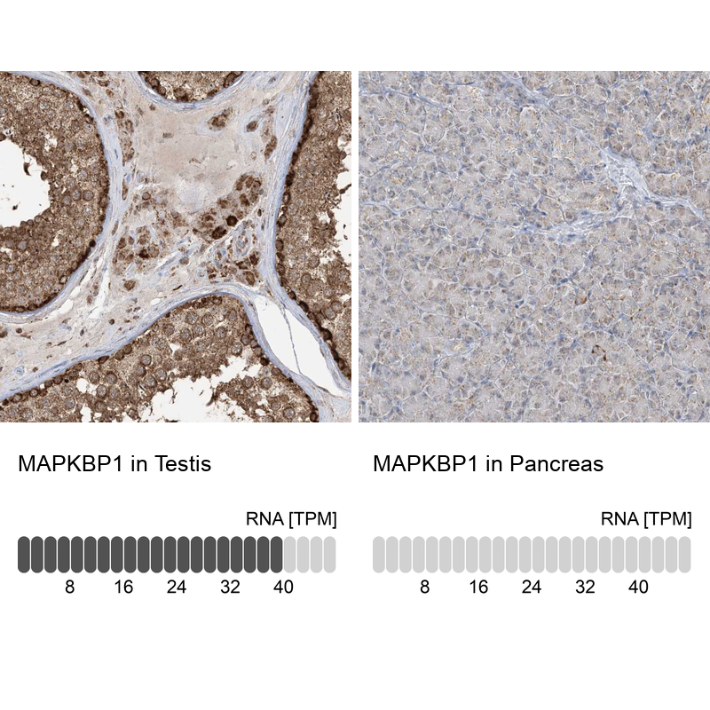 Atlas Antibodies Anti-MAPKBP1 Antibody