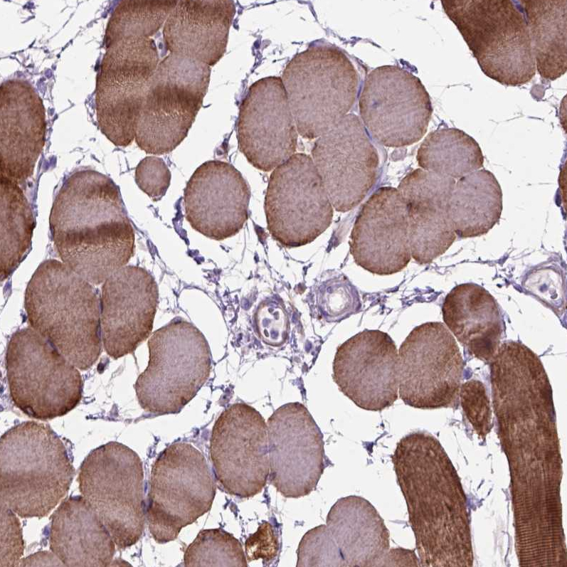 Atlas Antibodies Anti-MAPT Antibody