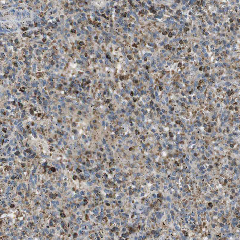 Atlas Antibodies Anti-MARCH1 Antibody