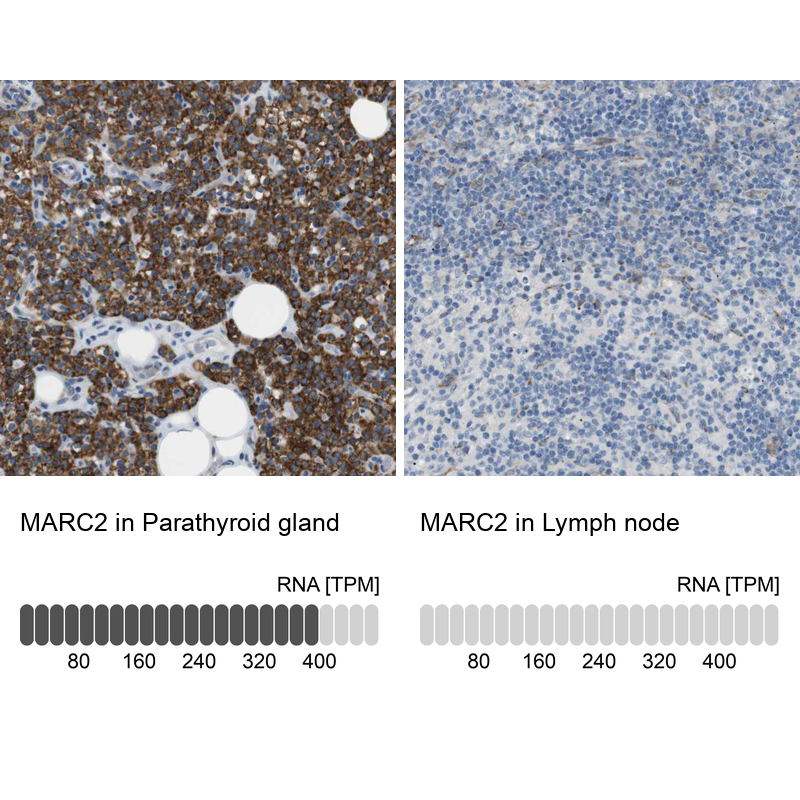 Atlas Antibodies Anti-MARC2 Antibody
