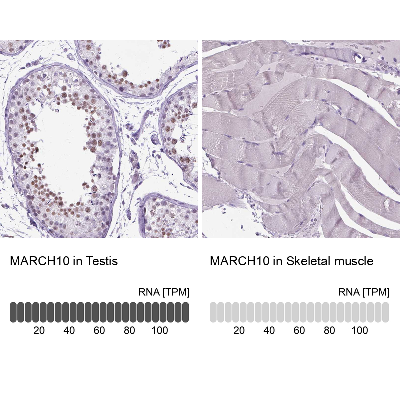Atlas Antibodies Anti-MARCH10 Antibody