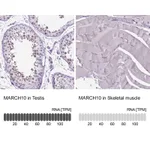 Atlas Antibodies Anti-MARCH10 Antibody