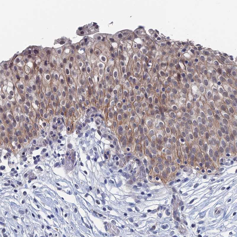 Atlas Antibodies Anti-MARCH3 Antibody