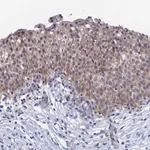 Atlas Antibodies Anti-MARCH3 Antibody