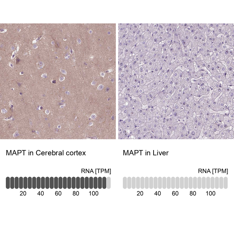 Atlas Antibodies Anti-MAPT Antibody