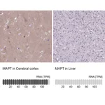 Atlas Antibodies Anti-MAPT Antibody