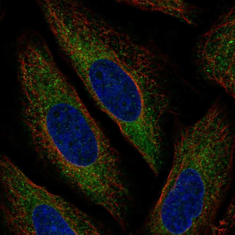 Atlas Antibodies Anti-MARCH6 Antibody