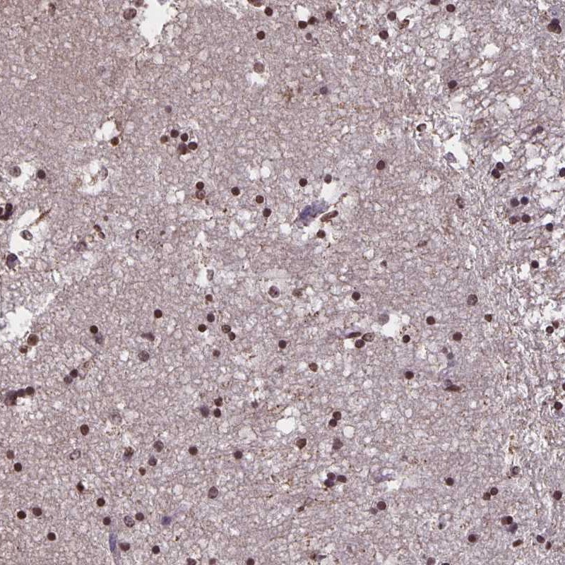 Atlas Antibodies Anti-MARCH6 Antibody