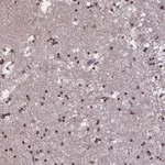 Atlas Antibodies Anti-MARCH6 Antibody