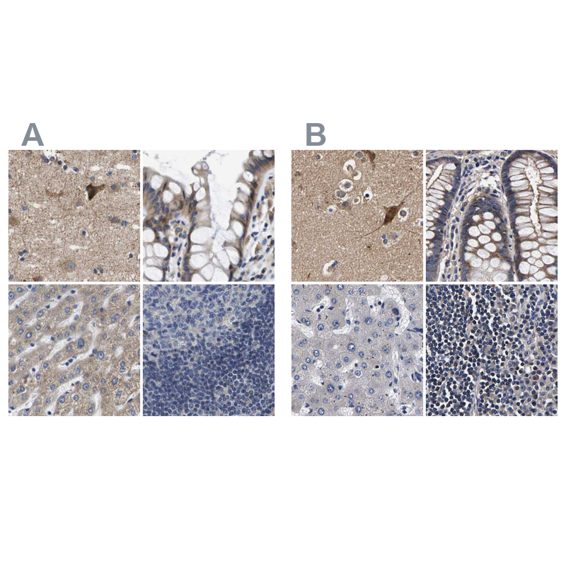 Atlas Antibodies Anti-MARCH7 Antibody