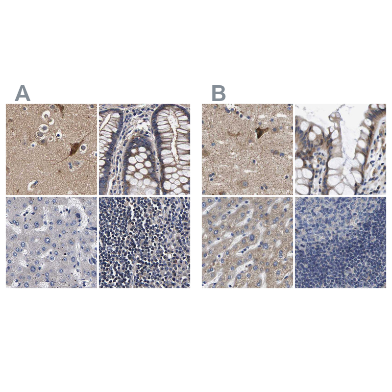 Atlas Antibodies Anti-MARCH7 Antibody