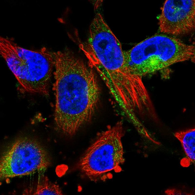 Atlas Antibodies Anti-MARCKS Antibody