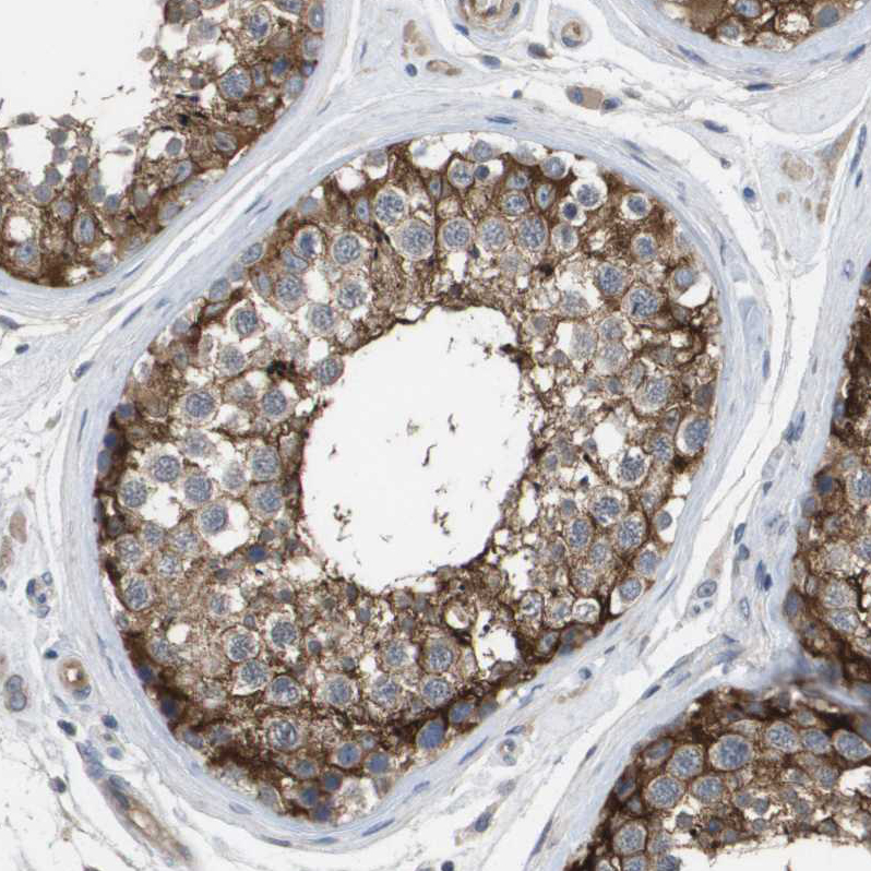 Atlas Antibodies Anti-MARCH8 Antibody