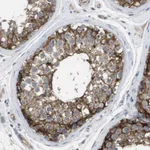 Atlas Antibodies Anti-MARCH8 Antibody