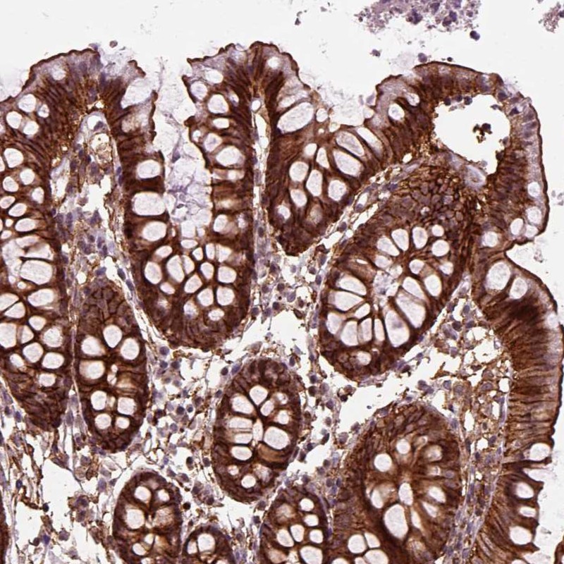 Atlas Antibodies Anti-MARCKS Antibody